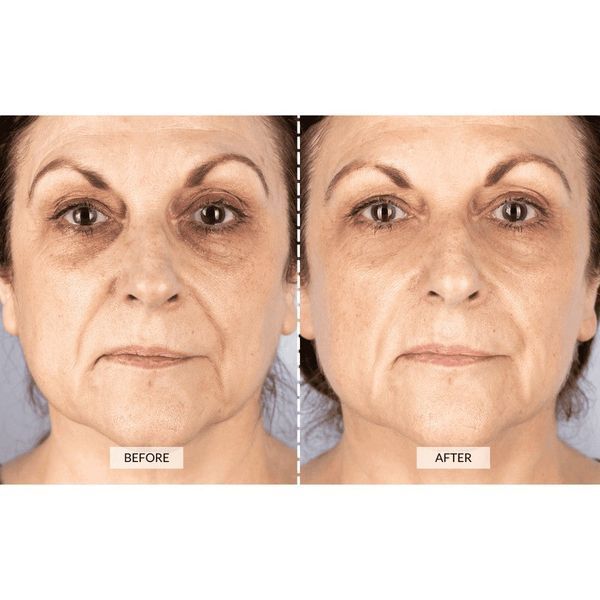 Світлодіодна маска CurrentBody Skin Mask RED LED Visage 112115 фото