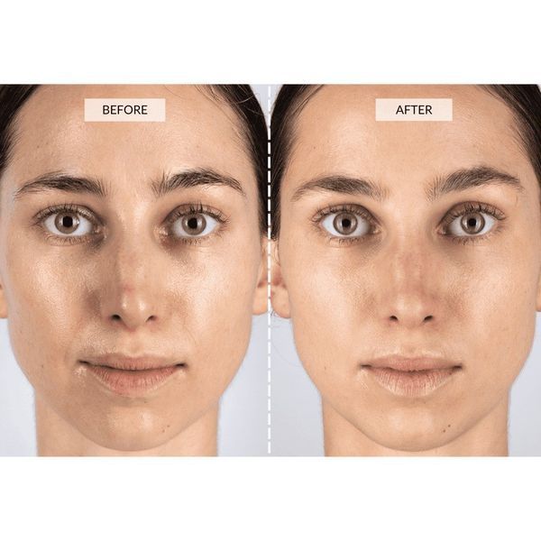 Світлодіодна маска CurrentBody Skin Mask RED LED Visage 112115 фото