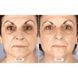 Світлодіодна маска CurrentBody Skin Mask RED LED Visage 112115 фото 4