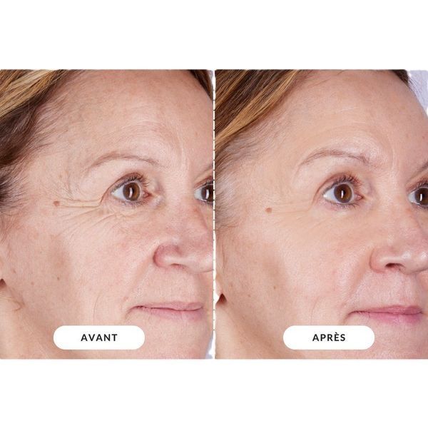 Светодиодная маска CurrentBody Skin LED RED Light Therapy Face Mask: Series 2 нового поколения 117522 фото