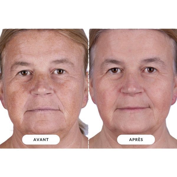 Светодиодная маска CurrentBody Skin LED RED Light Therapy Face Mask: Series 2 нового поколения 117522 фото