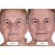 Светодиодная маска CurrentBody Skin LED RED Light Therapy Face Mask: Series 2 нового поколения 117522 фото 7